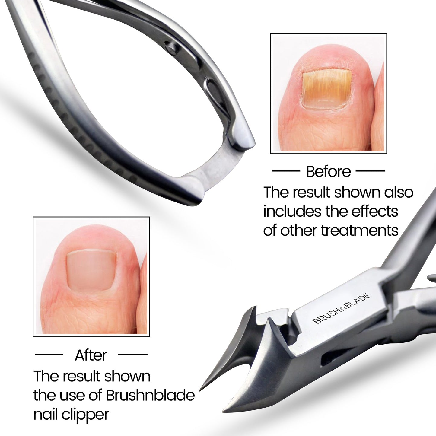 Moon Edge Toenail Clippers for Thick and Ingrown Nails