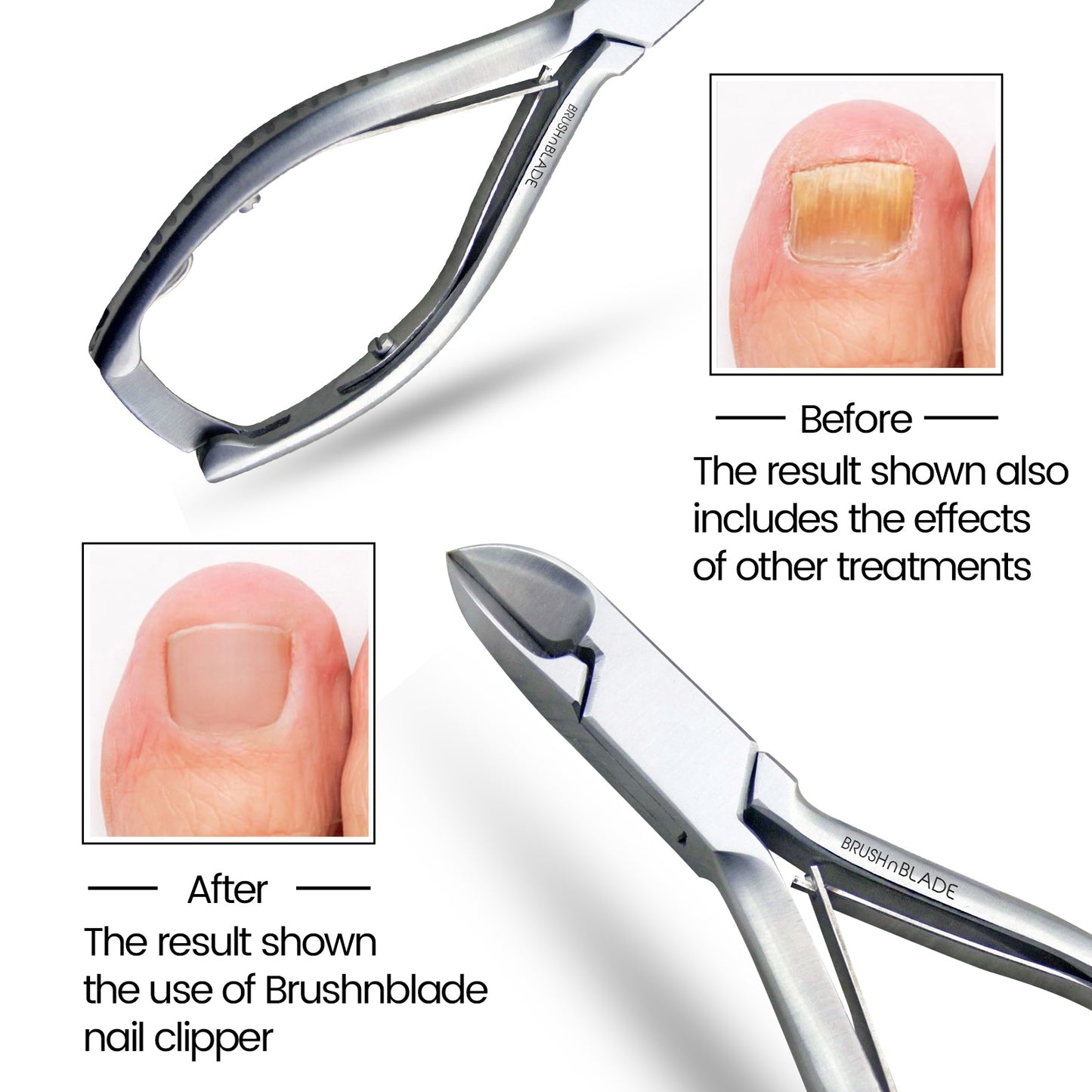 5 Inch Toenail Clippers for Thick Nails Stainless Steel